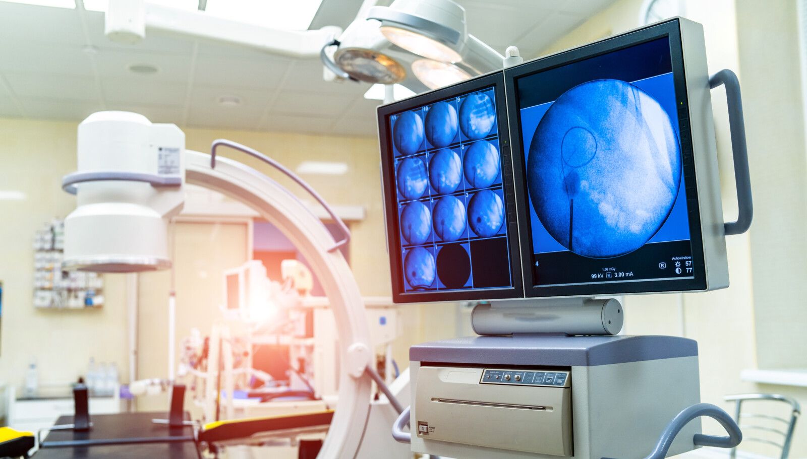 Digital X-ray at a diagnostic centre compared with a portable X-ray machine used at home in Bandra
