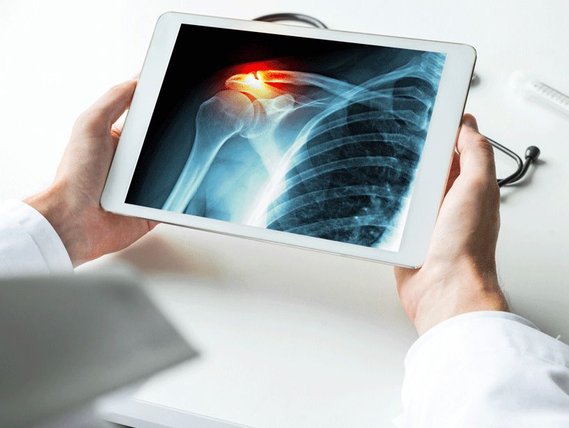 Portable digital X-ray equipment set up at a patient's home in Bandra
